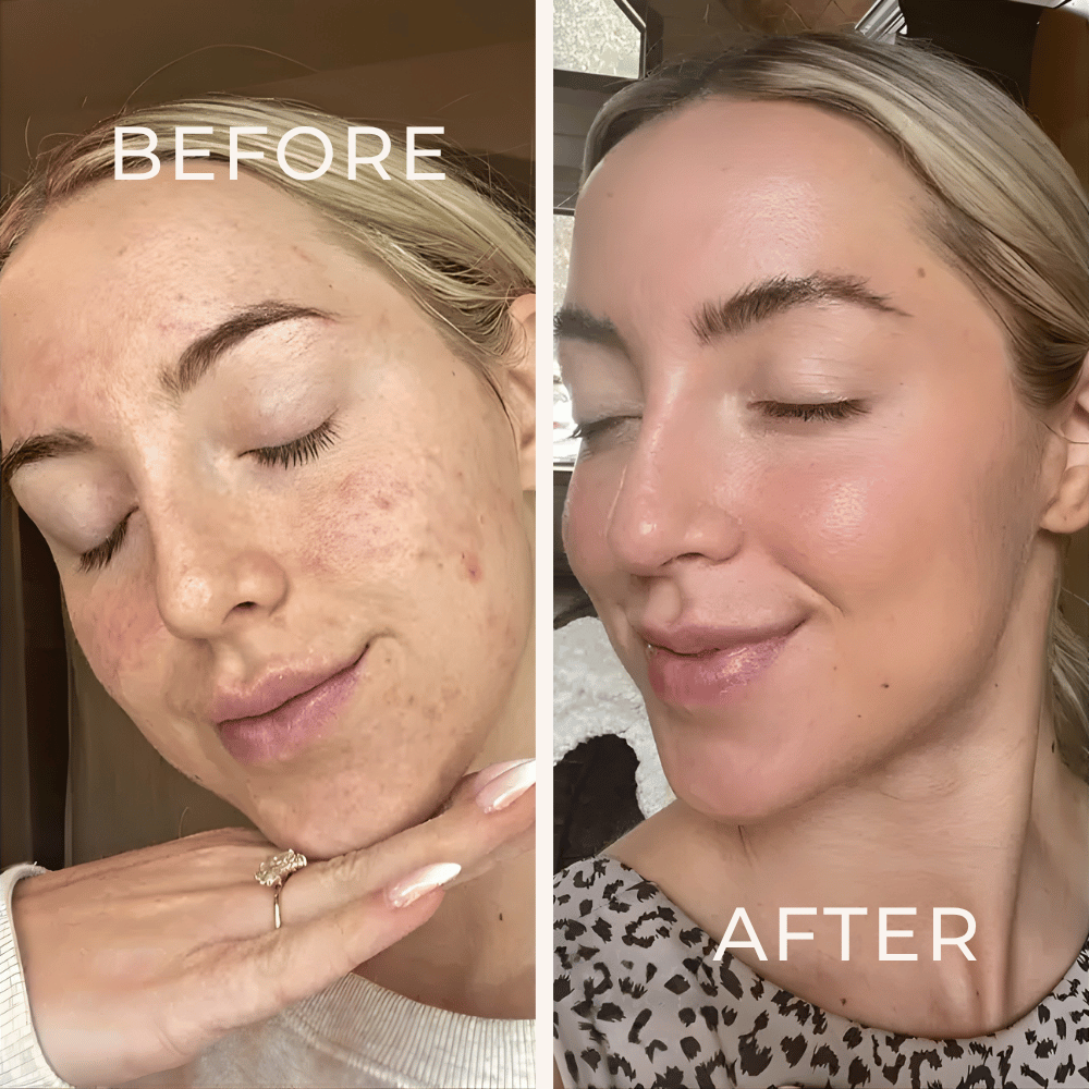 Skinly Glass Skin Routine